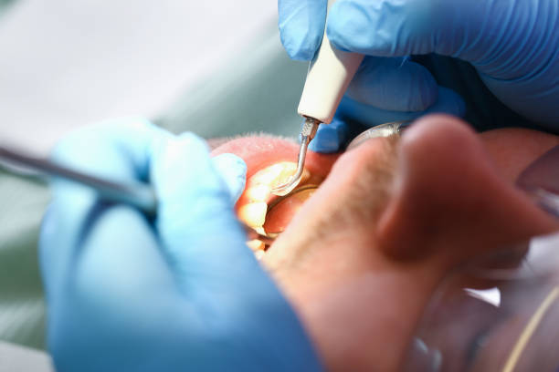Best Emergency Dental Surgery in Denton, NC